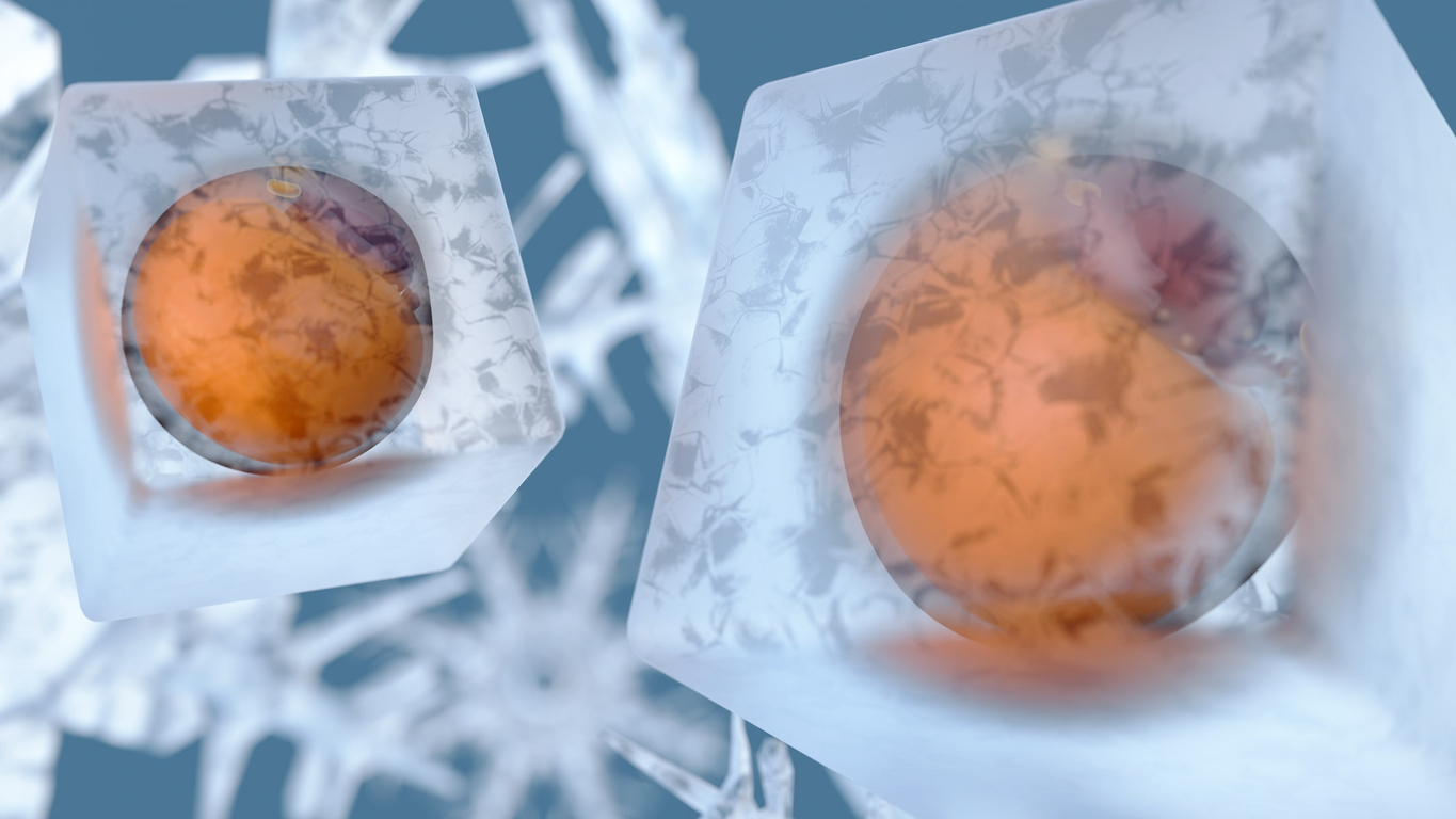 脂肪冷却のメリット・デメリットは？安全性やリスクを解説