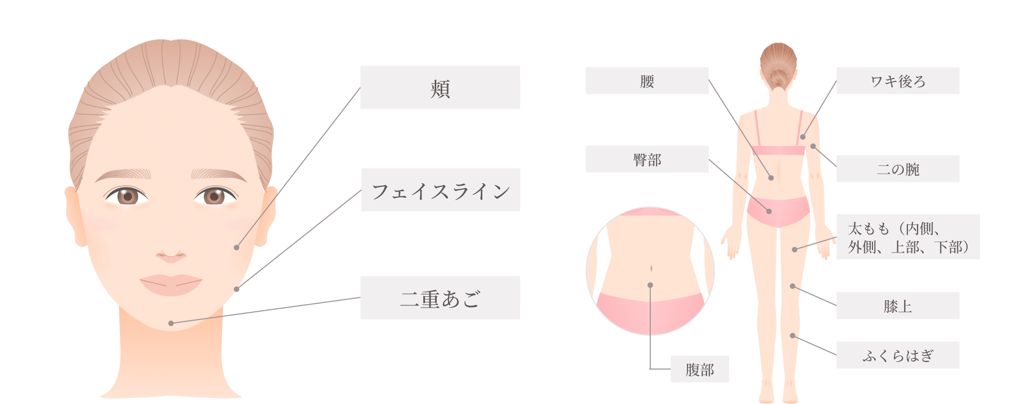 カベルライン適応部位