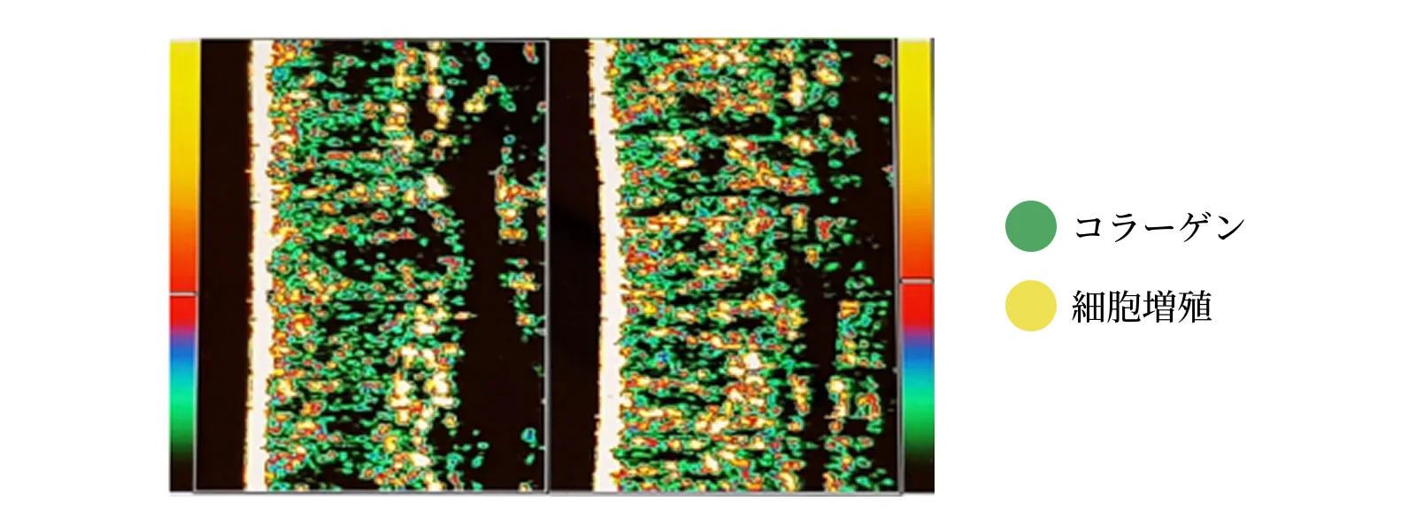 BioRePeelCl3のエビデンス