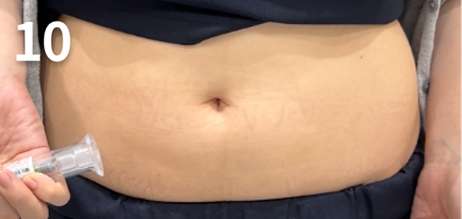 極細の針を使うため跡も残らず、出血もありません