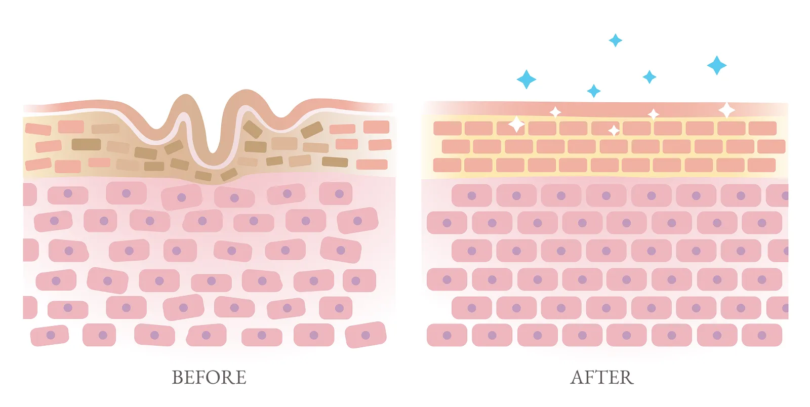 ミラノリピールのビフォーアフターのイメージ