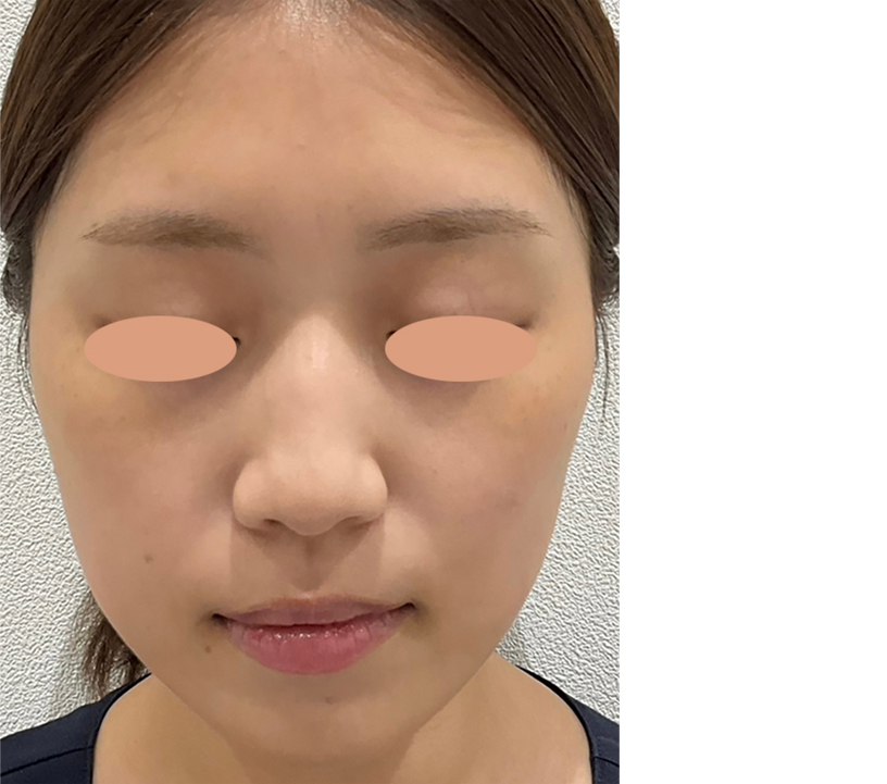 症例写真アフター