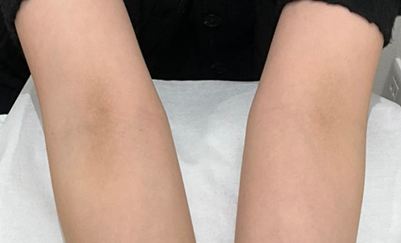 症例写真アフター