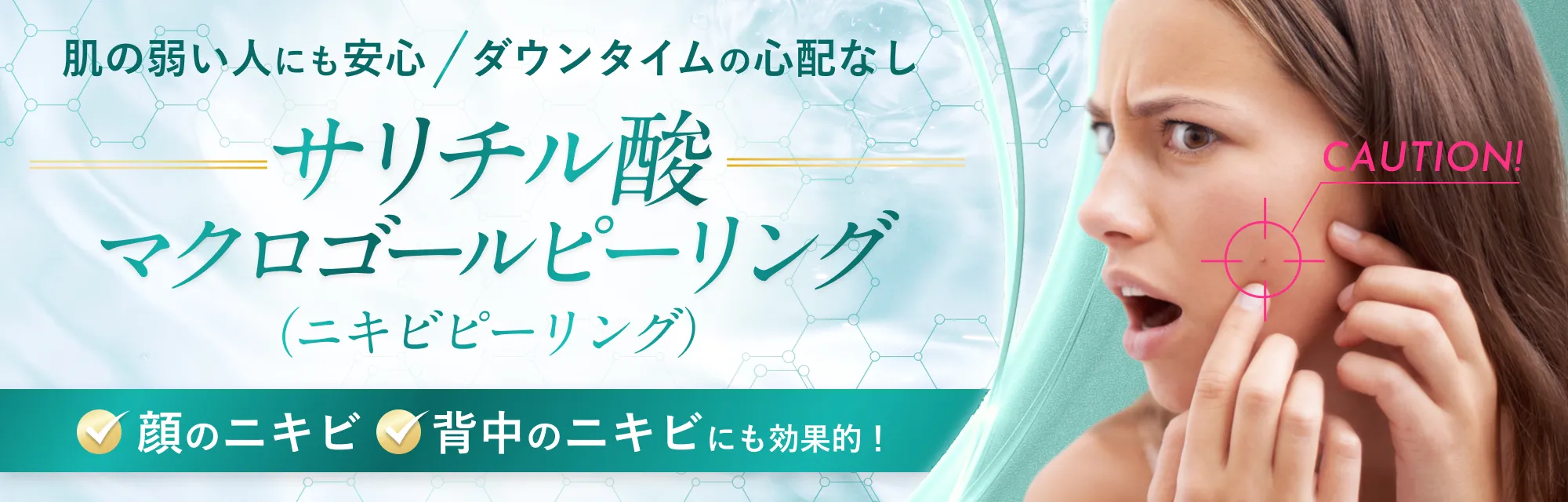 サリチル酸マクロゴールピーリング（ニキビピーリング）