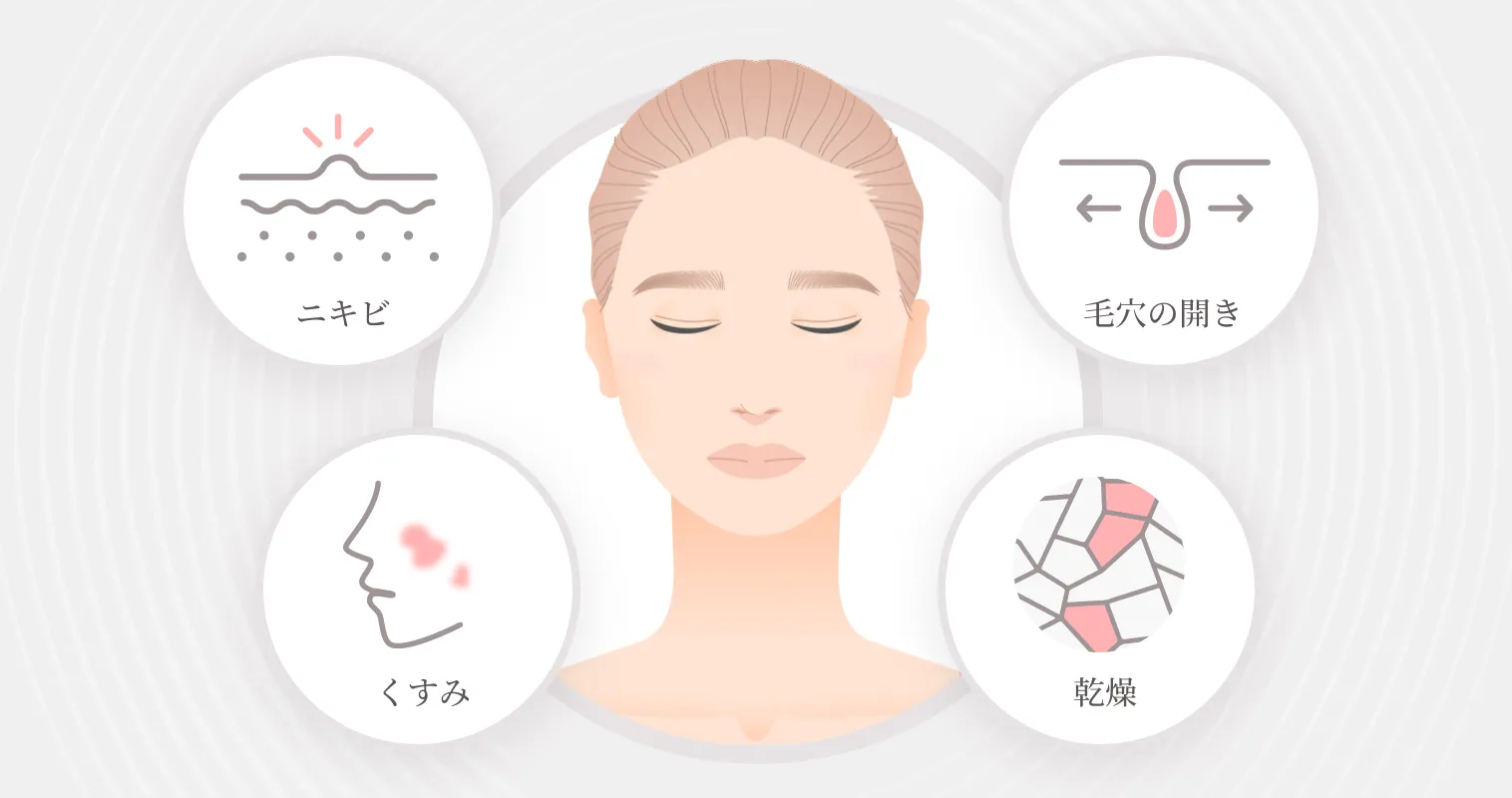 サリチル酸マクロゴールピーリング（ニキビピーリング）の特徴