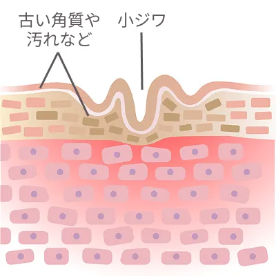 古い角質や汚れがついた状態