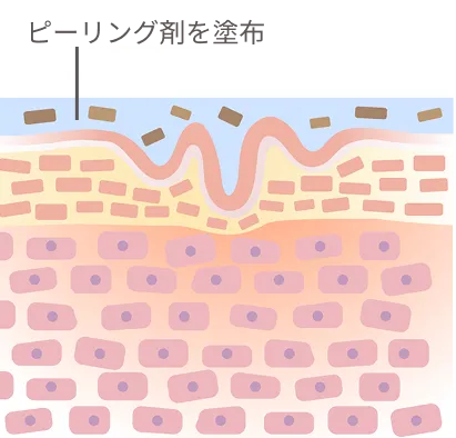 ピーリング剤が角質層に作用し、新陳代謝を促進