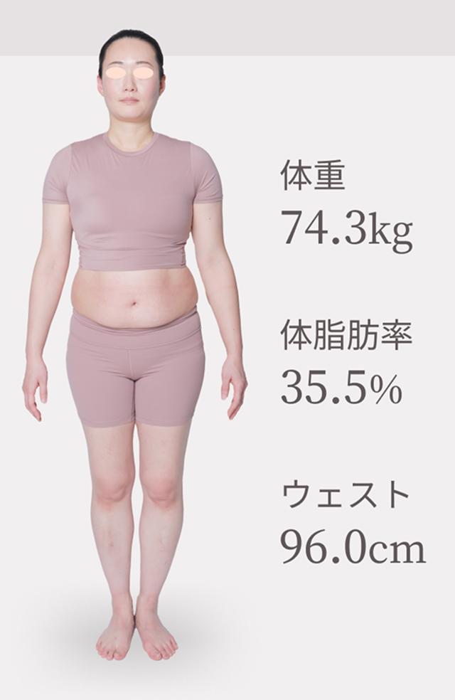 症例写真ビフォー