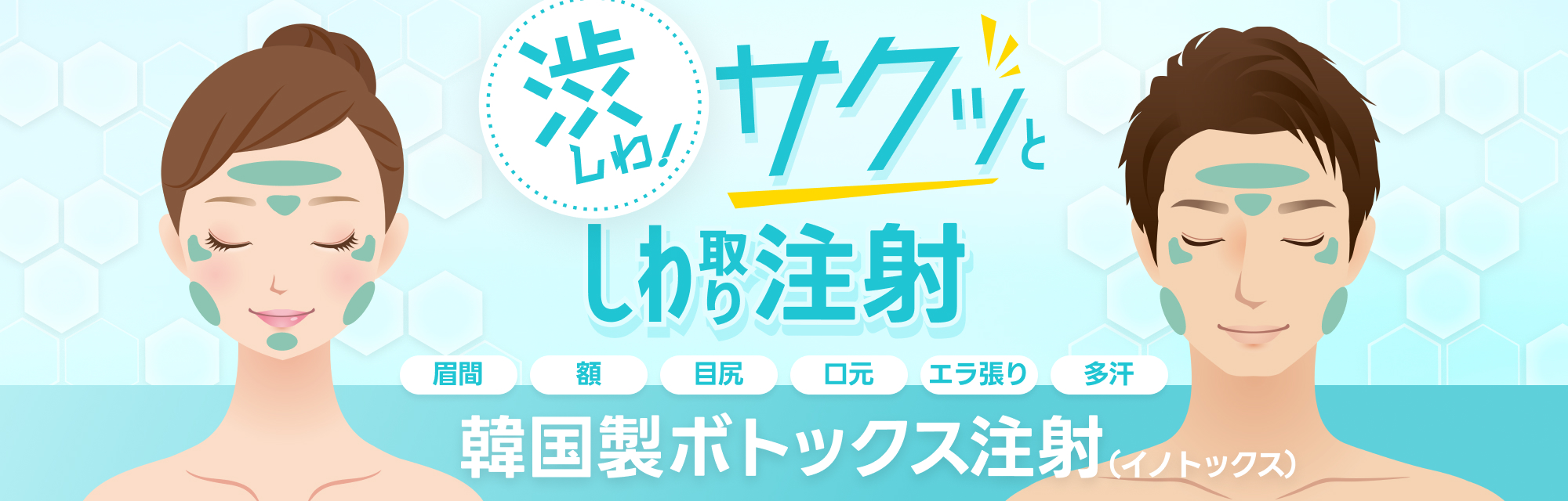 韓国製ボトックス注射（イノトックス）