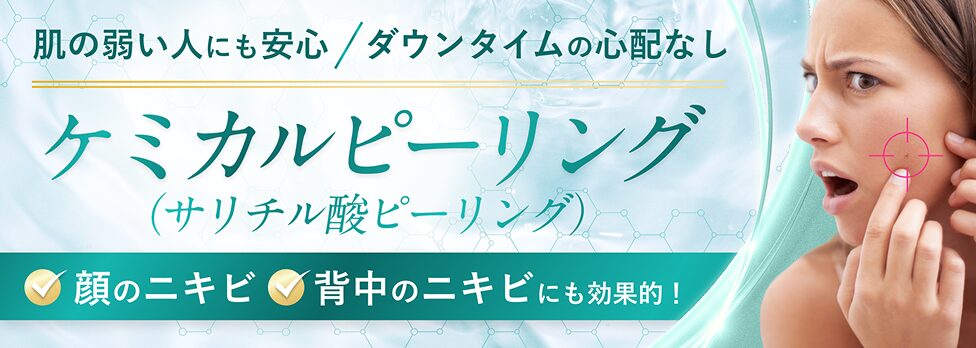 ケミカルピーリング